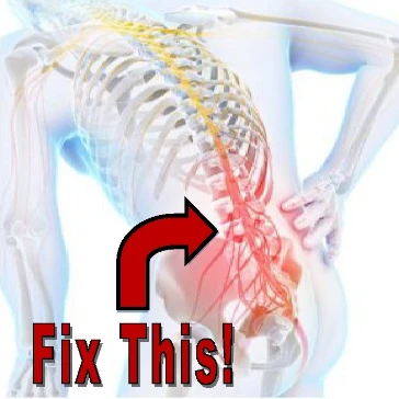 How to prevent arthritis from ending you up in a surgery lesson poster
