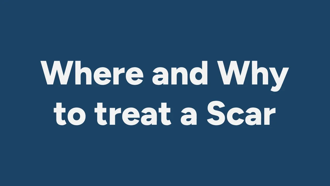 When and Why to treat a Scar lesson poster