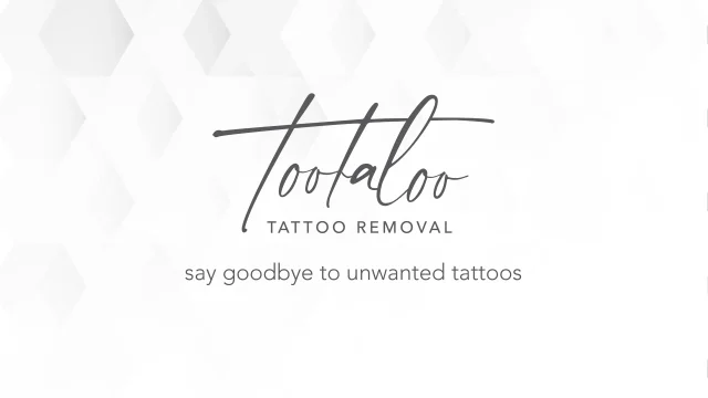 Tootaloo Saline Tattoo Removal