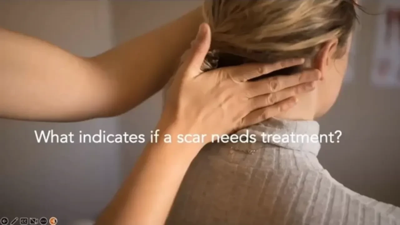 What indicates that scar requires Gentle Scar Therapy lesson poster