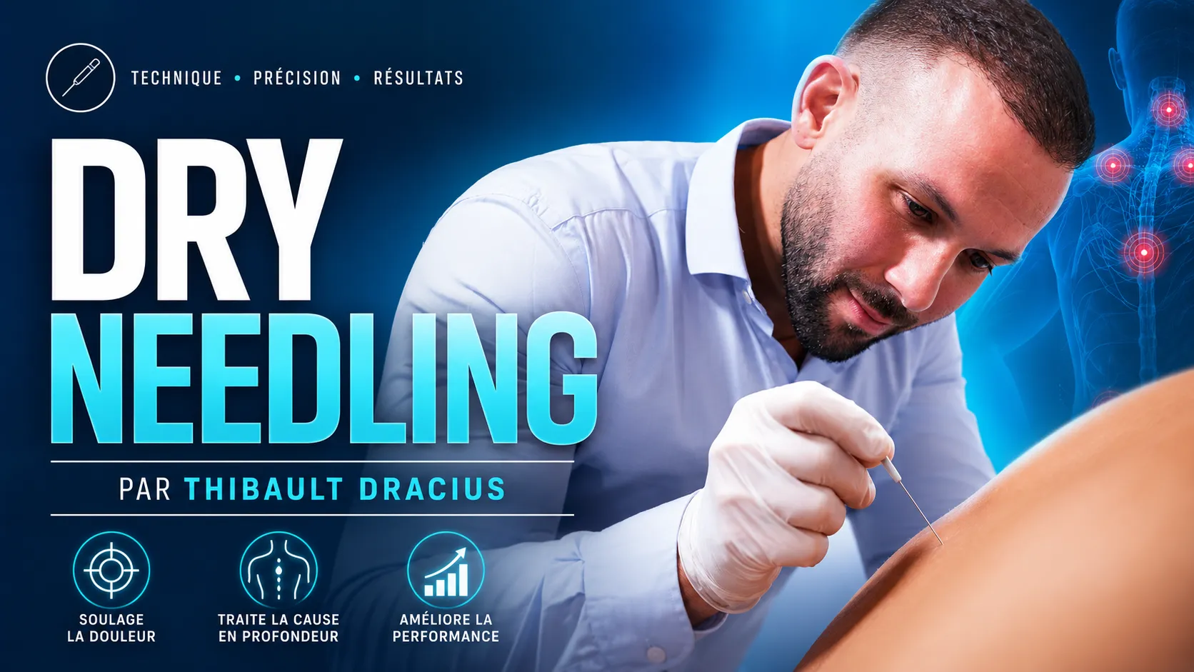 Dry needling