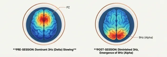 Brain Activity Before and After: Visualizing Changes in Neural Balance lesson poster