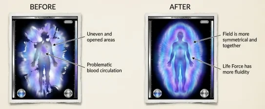 Quantifying the Human Bio-Field: Before and After lesson poster